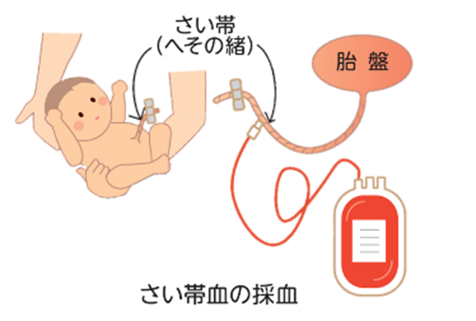 さい帯血バンクについて｜北海道ブロック血液センター｜日本赤十字社
